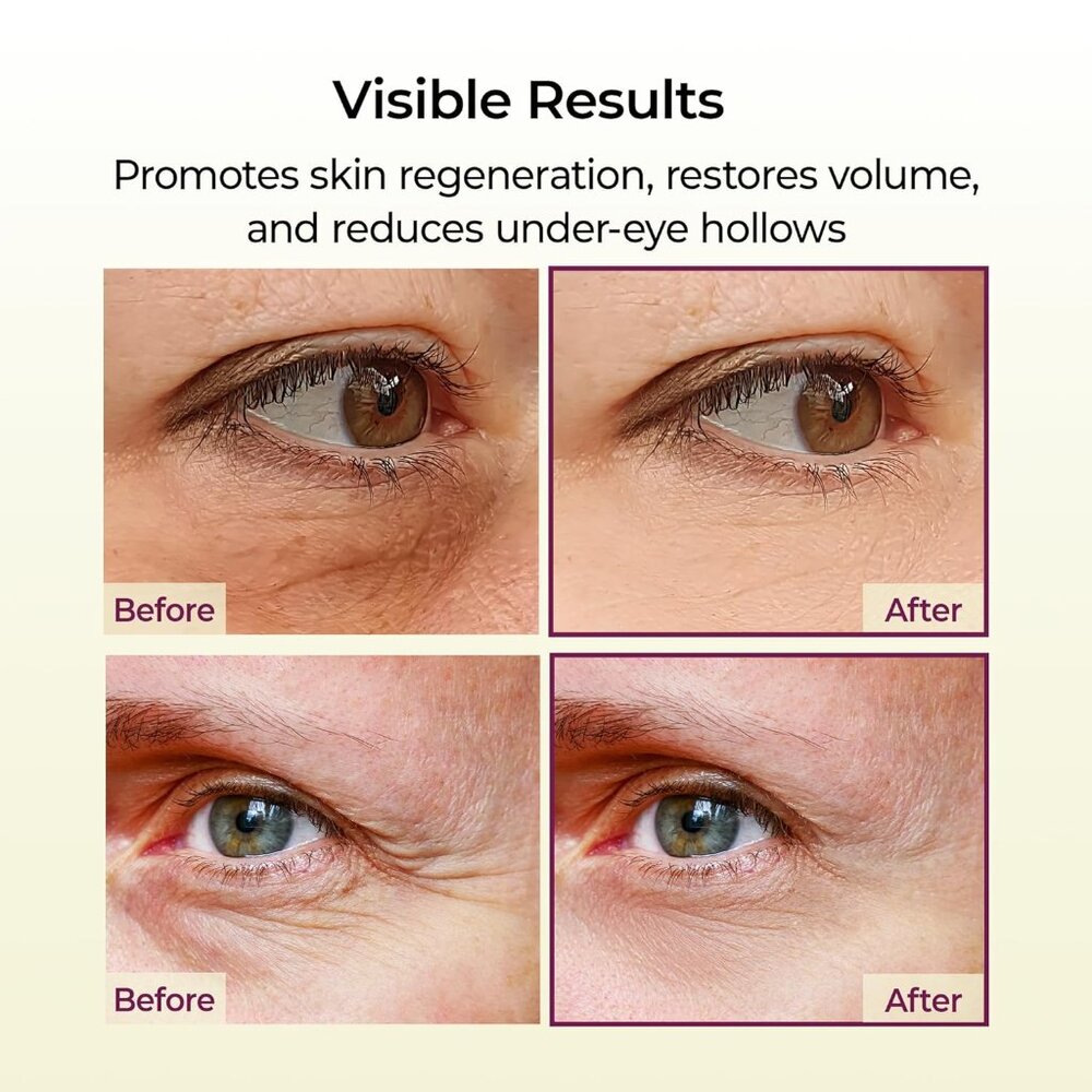 Dr. Melaxin Cemenrete Calcium Volume Multi Balm Volume Stick - Picture 4 of 4
